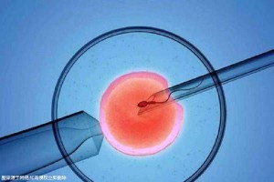 志愿者借卵代孕咨询怎么收费
